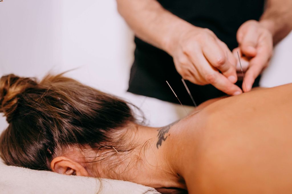 acupuncture for back pain