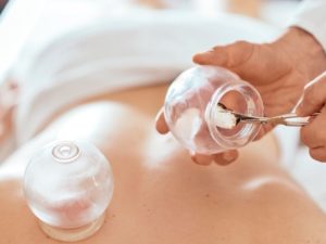 cupping therapy4