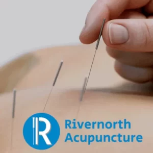 best acupuncture clinic diamond bar pomona upland near me