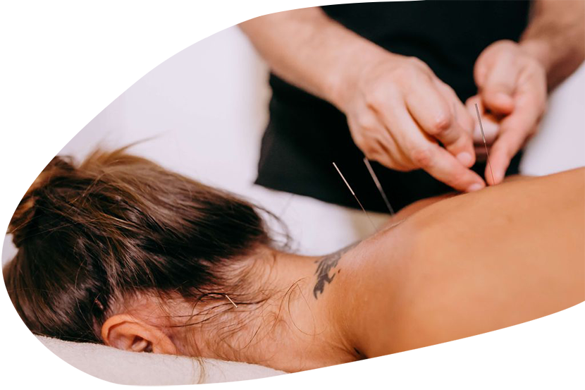 patient is getting acupuncture treatment from the highly educated acupuncturist from the clinic in California using her insurance benefit with minimum copay